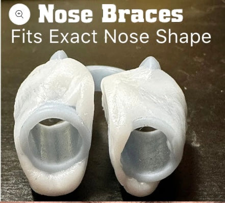 Moldable custom nose vent kit to help you sleep and fix a deviated septum