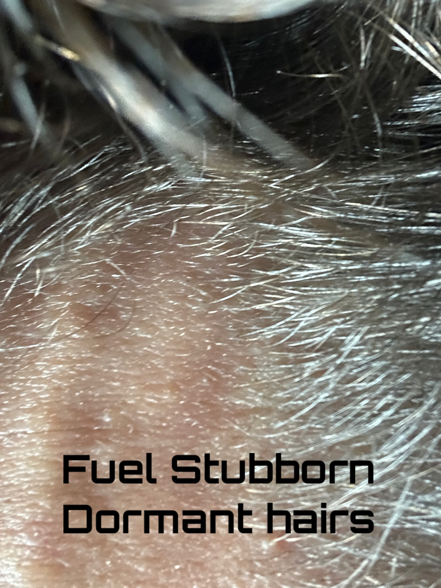 3-in-1 Hair Hyper Growth Serum || Moisturizer, Muscle Relaxer, and Nutrients for Hair Volume and Thickness
