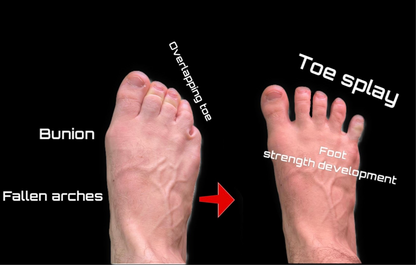 Customizable Toe Splay Trainer Kit with Training Program Included