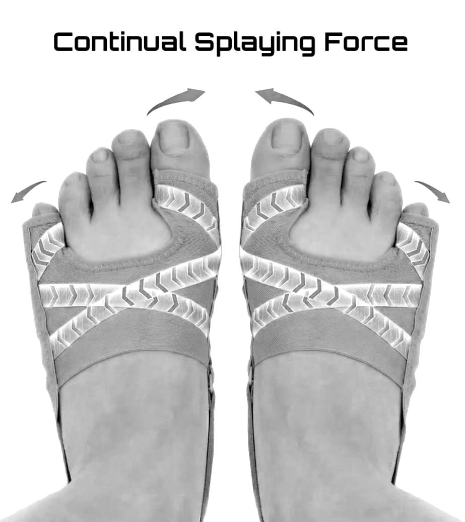 Toe Splay Trainer Kit (Training Program Included)
